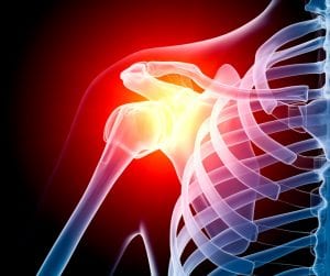 Shoulder Injury X-Ray