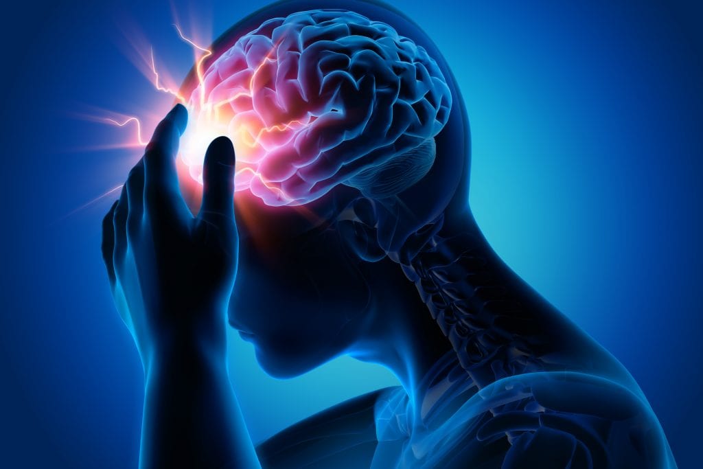 3D image of post concussion syndrome after traumatic brain injury