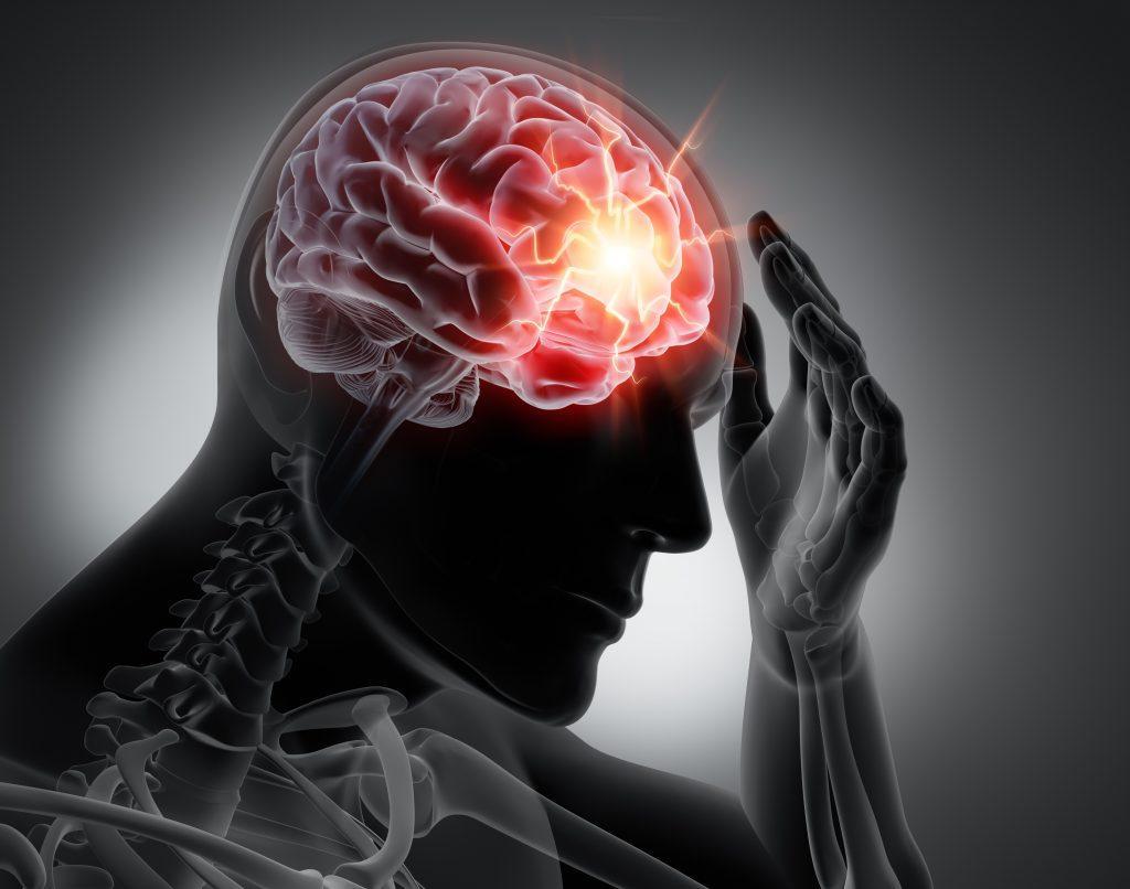 Brain imaging of man with a mild traumatic brain injury.